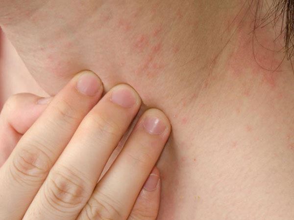 tác hại của nước hoa kích dục giả